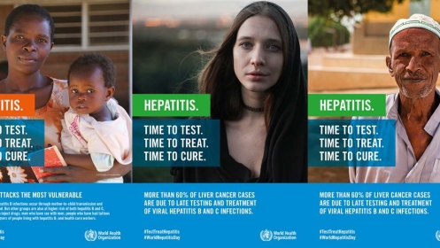 Svjetski dan hepatitisa: Virusni hepatitis je rastući svjetski zdravstveni problem