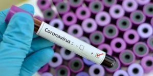 U TK potvrđeno 38 novih slučajeva zaraze koronavirusom