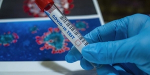 U FBiH 577 novih slučajeva koronavirusa, testirano 3.248 uzorka